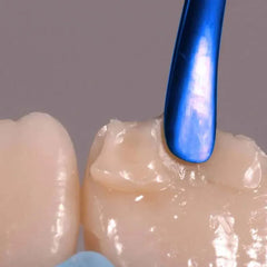 Prime Dental Pro-Whitening Gel | Advanced Teeth Whitening Solution | Professional-Grade Formula for Instant Results | Safe for Sensitive Teeth | Includes Custom Whitening Tray | 10 ml (1)